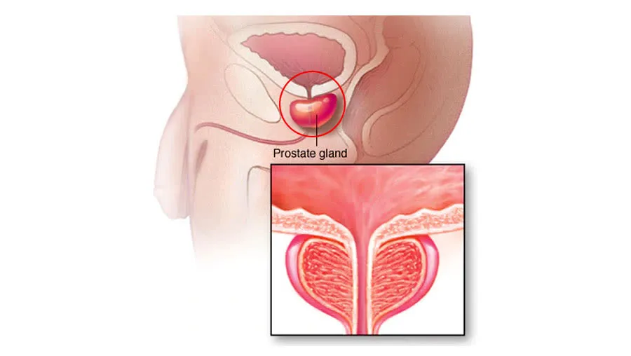 Prostate anatomy diagram